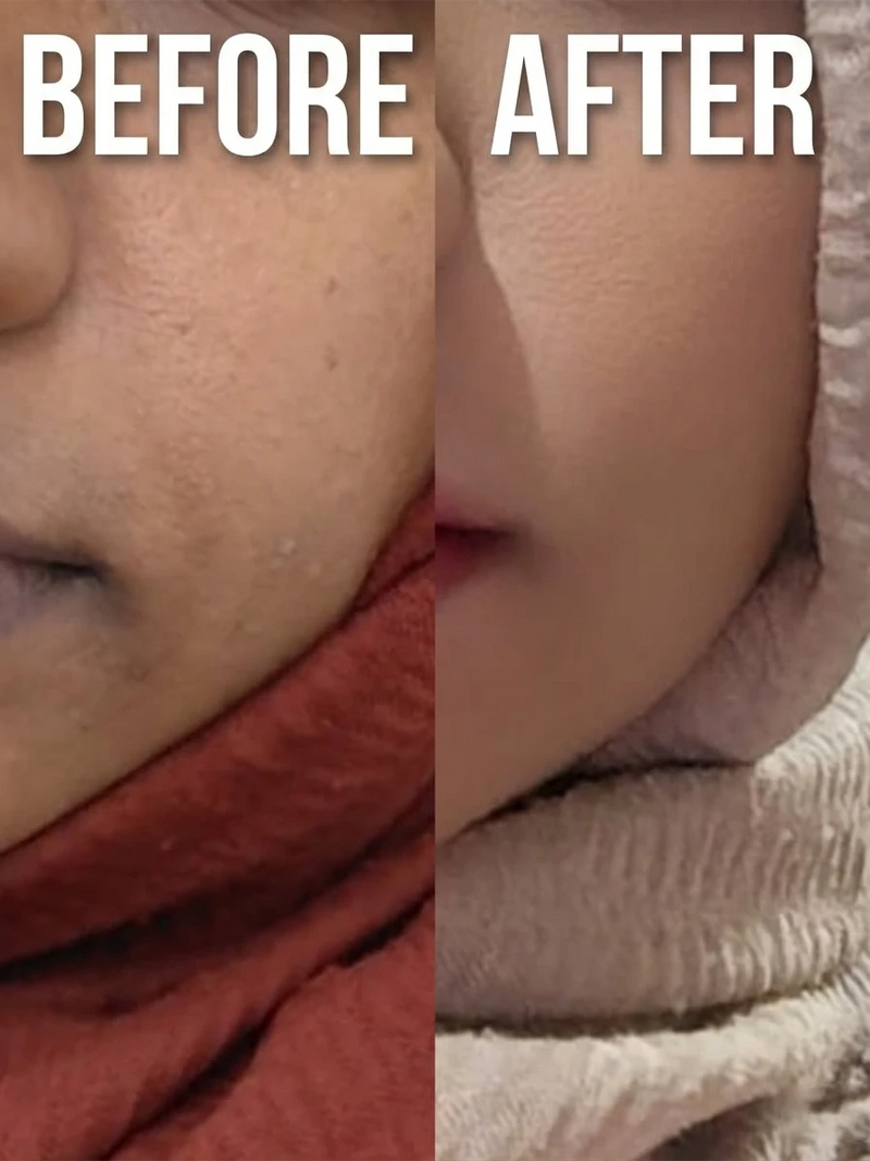 After